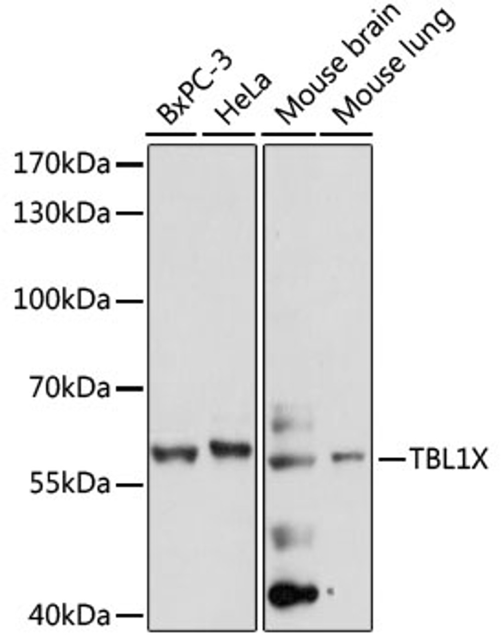 Western blot analysis of extracts of various cell lines, using TBL1X antibody (15-880) at 1:1000 dilution.<br/>Secondary antibody: HRP Goat Anti-Rabbit IgG (H+L) at 1:10000 dilution.<br/>Lysates/proteins: 25ug per lane.<br/>Blocking buffer: 3% nonfat dry milk in TBST.<br/>Detection: ECL Basic Kit.<br/>Exposure time: 60s.