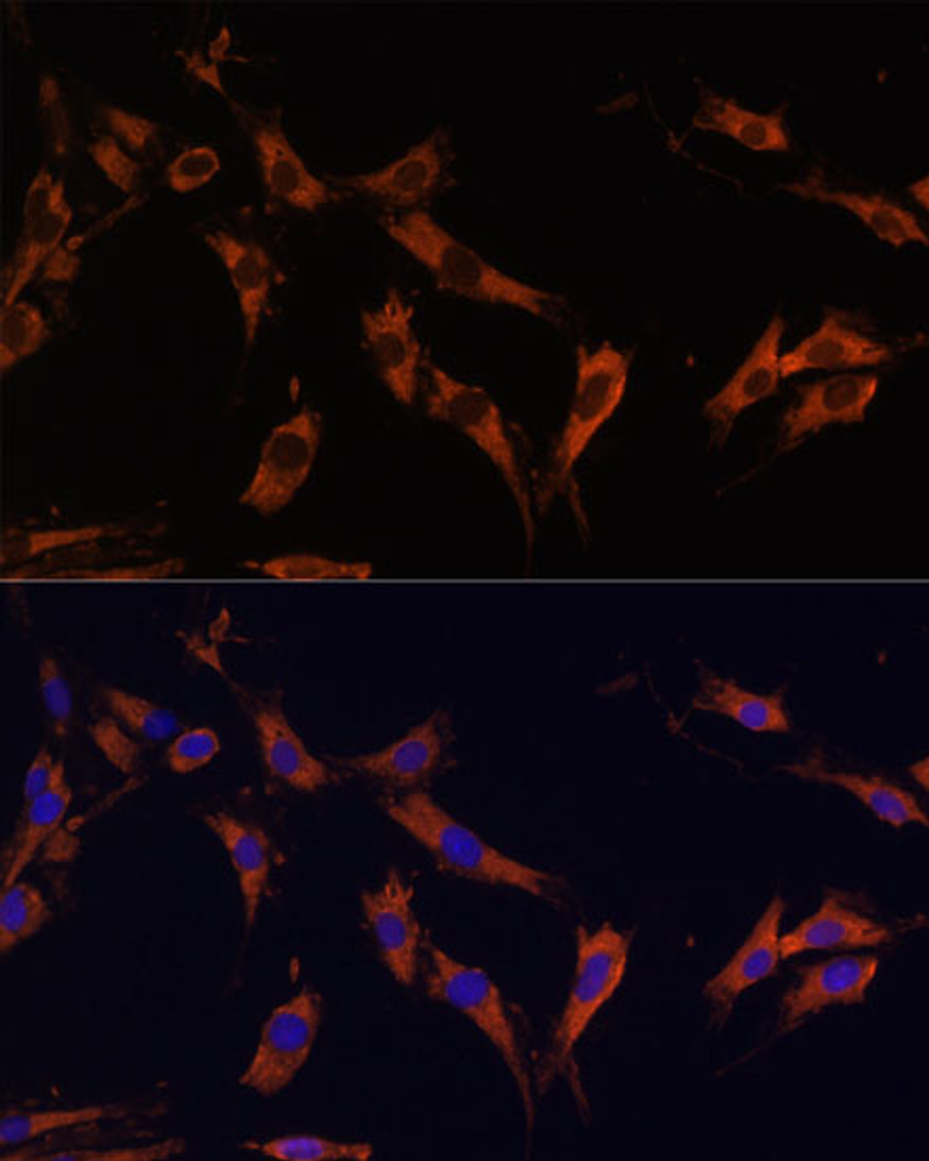 Immunofluorescence analysis of C6 cells using KSR1 Polyclonal Antibody (15-886) at dilution of 1:100 (40x lens) . Blue: DAPI for nuclear staining.