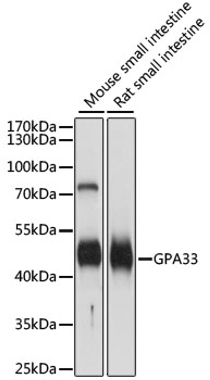 Western blot analysis of extracts of various cell lines, using GPA33 antibody (15-890) at 1:1000 dilution.<br/>Secondary antibody: HRP Goat Anti-Rabbit IgG (H+L) at 1:10000 dilution.<br/>Lysates/proteins: 25ug per lane.<br/>Blocking buffer: 3% nonfat dry milk in TBST.<br/>Detection: ECL Basic Kit.<br/>Exposure time: 1s.