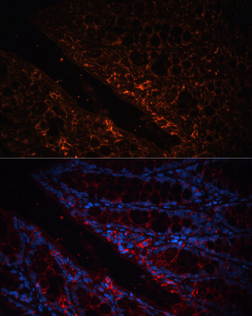 Immunofluorescence analysis of mouse colon using GPA33 antibody (15-890) at dilution of 1:100. Blue: DAPI for nuclear staining.