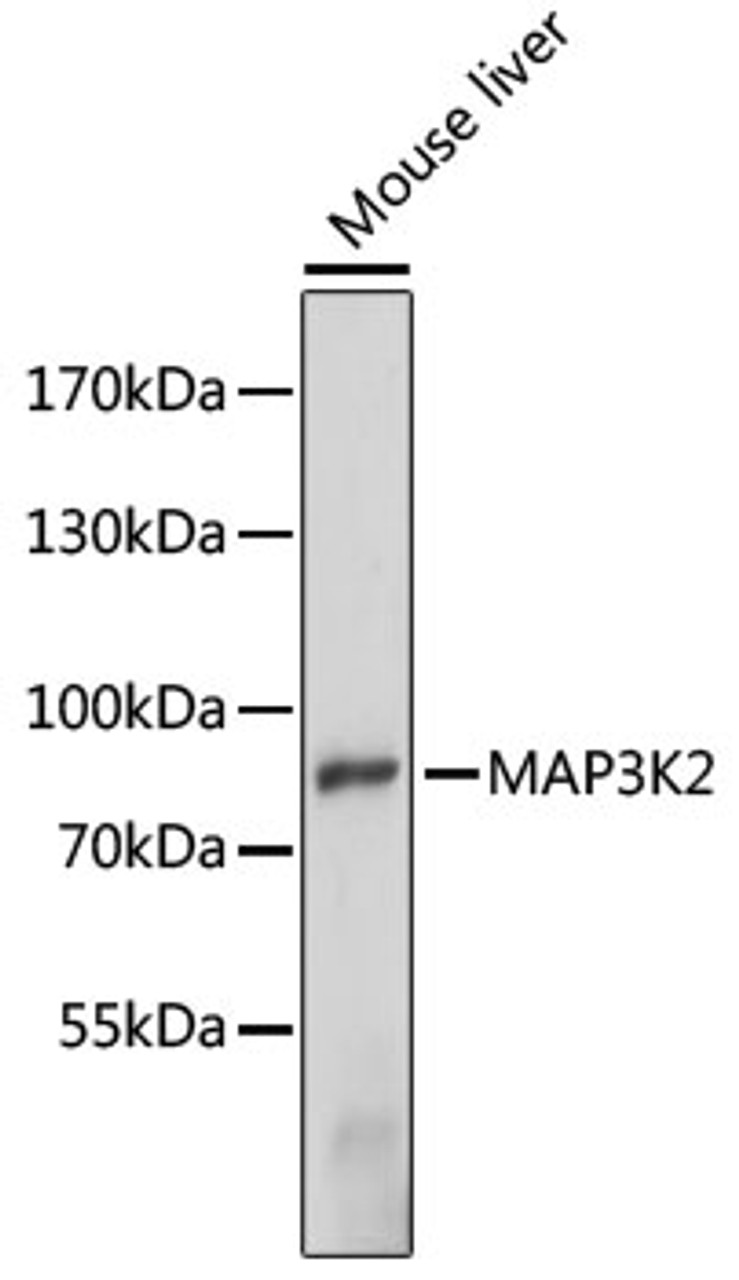 Western blot analysis of extracts of mouse liver, using MAP3K2 antibody (15-896) at 1:1000 dilution.<br/>Secondary antibody: HRP Goat Anti-Rabbit IgG (H+L) at 1:10000 dilution.<br/>Lysates/proteins: 25ug per lane.<br/>Blocking buffer: 3% nonfat dry milk in TBST.<br/>Detection: ECL Enhanced Kit.<br/>Exposure time: 90s.