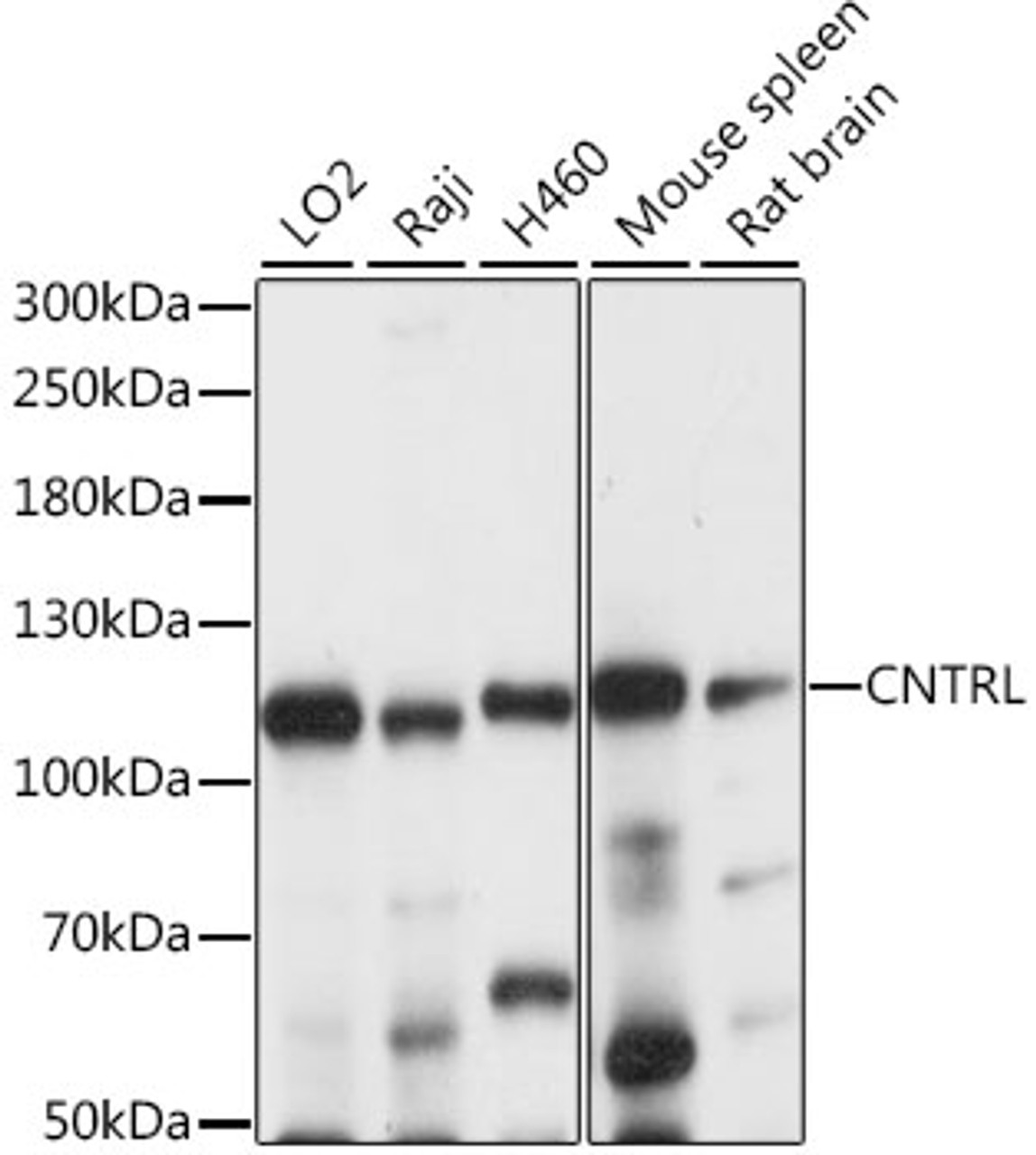 Western blot analysis of extracts of various cell lines, using CNTRL antibody (15-898) at 1:1000 dilution.<br/>Secondary antibody: HRP Goat Anti-Rabbit IgG (H+L) at 1:10000 dilution.<br/>Lysates/proteins: 25ug per lane.<br/>Blocking buffer: 3% nonfat dry milk in TBST.<br/>Detection: ECL Basic Kit.<br/>Exposure time: 5s.
