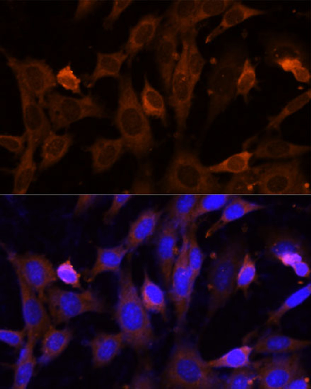 Immunofluorescence analysis of NIH-3T3 cells using VPS36 Polyclonal Antibody (15-906) at dilution of 1:100 (40x lens) . Blue: DAPI for nuclear staining.