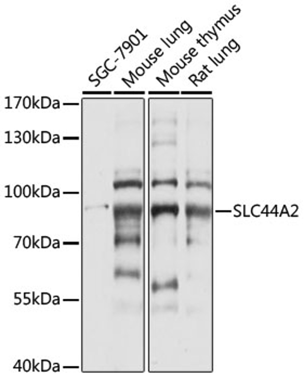 Western blot analysis of extracts of various cell lines, using SLC44A2 antibody (15-916) at 1:1000 dilution.<br/>Secondary antibody: HRP Goat Anti-Rabbit IgG (H+L) at 1:10000 dilution.<br/>Lysates/proteins: 25ug per lane.<br/>Blocking buffer: 3% nonfat dry milk in TBST.<br/>Detection: ECL Basic Kit.<br/>Exposure time: 5s.