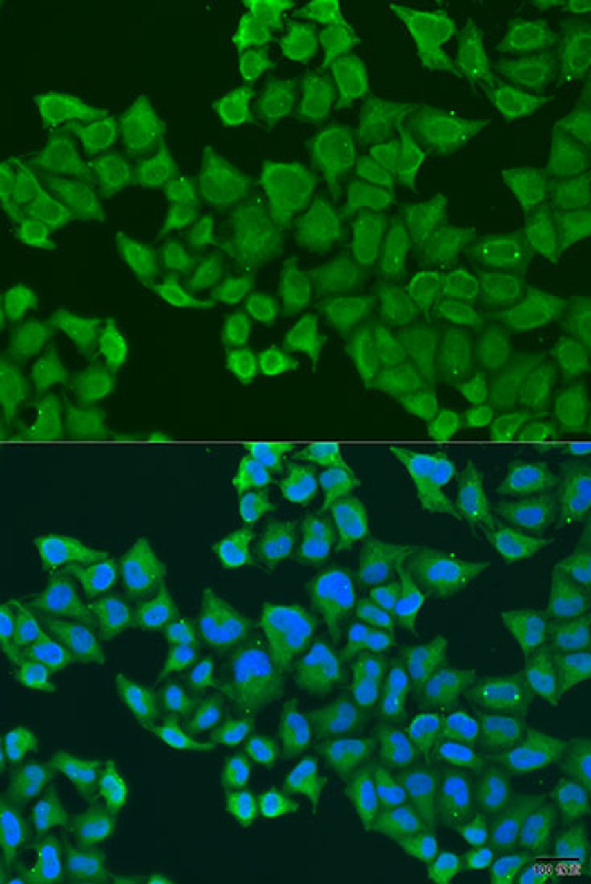 Immunofluorescence analysis of U2OS cells using ULBP2 antibody (15-921) at dilution of 1:100. Blue: DAPI for nuclear staining.