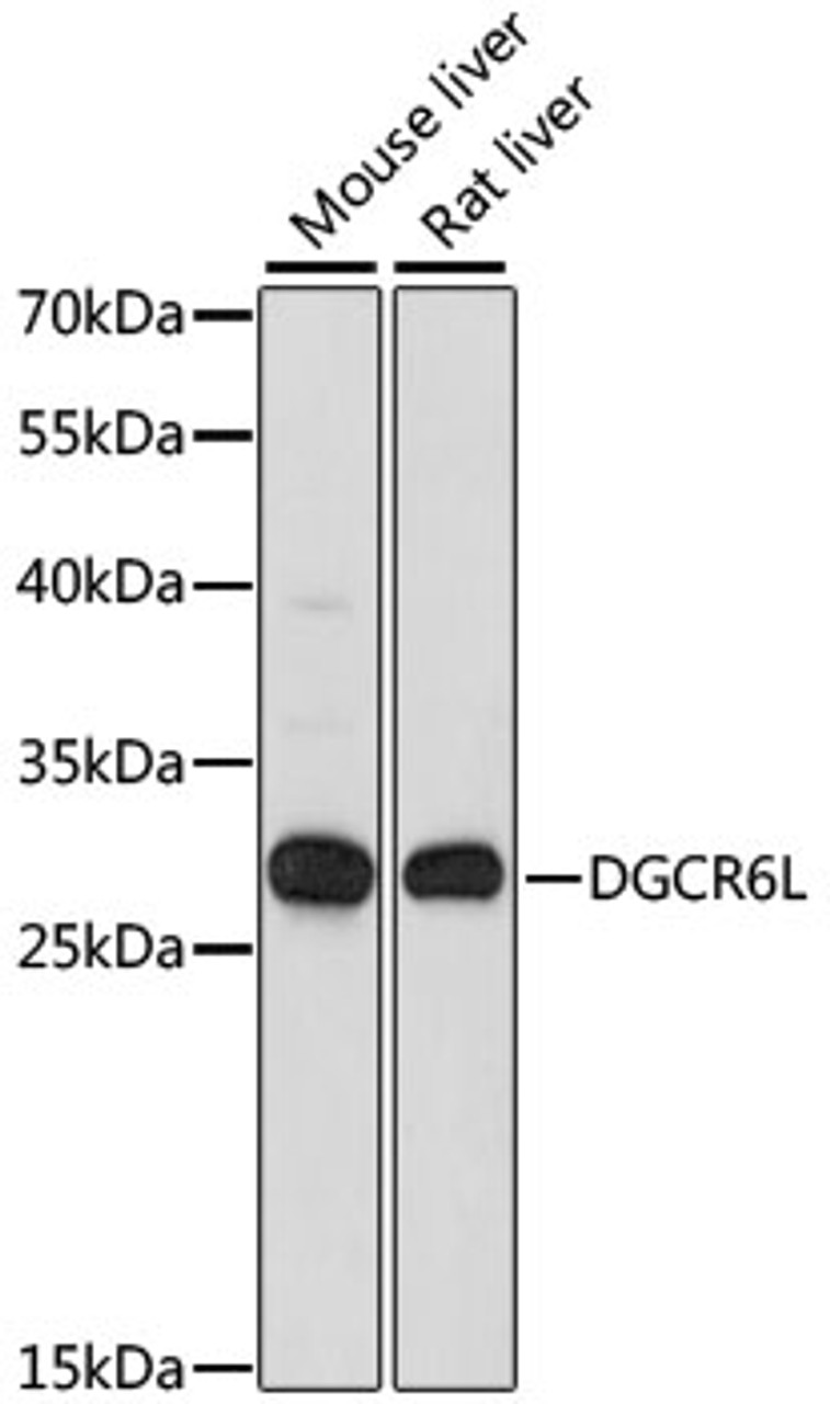 Western blot analysis of extracts of various cell lines, using DGCR6L antibody (15-926) at 1:1000 dilution.<br/>Secondary antibody: HRP Goat Anti-Rabbit IgG (H+L) at 1:10000 dilution.<br/>Lysates/proteins: 25ug per lane.<br/>Blocking buffer: 3% nonfat dry milk in TBST.<br/>Detection: ECL Basic Kit.<br/>Exposure time: 30s.