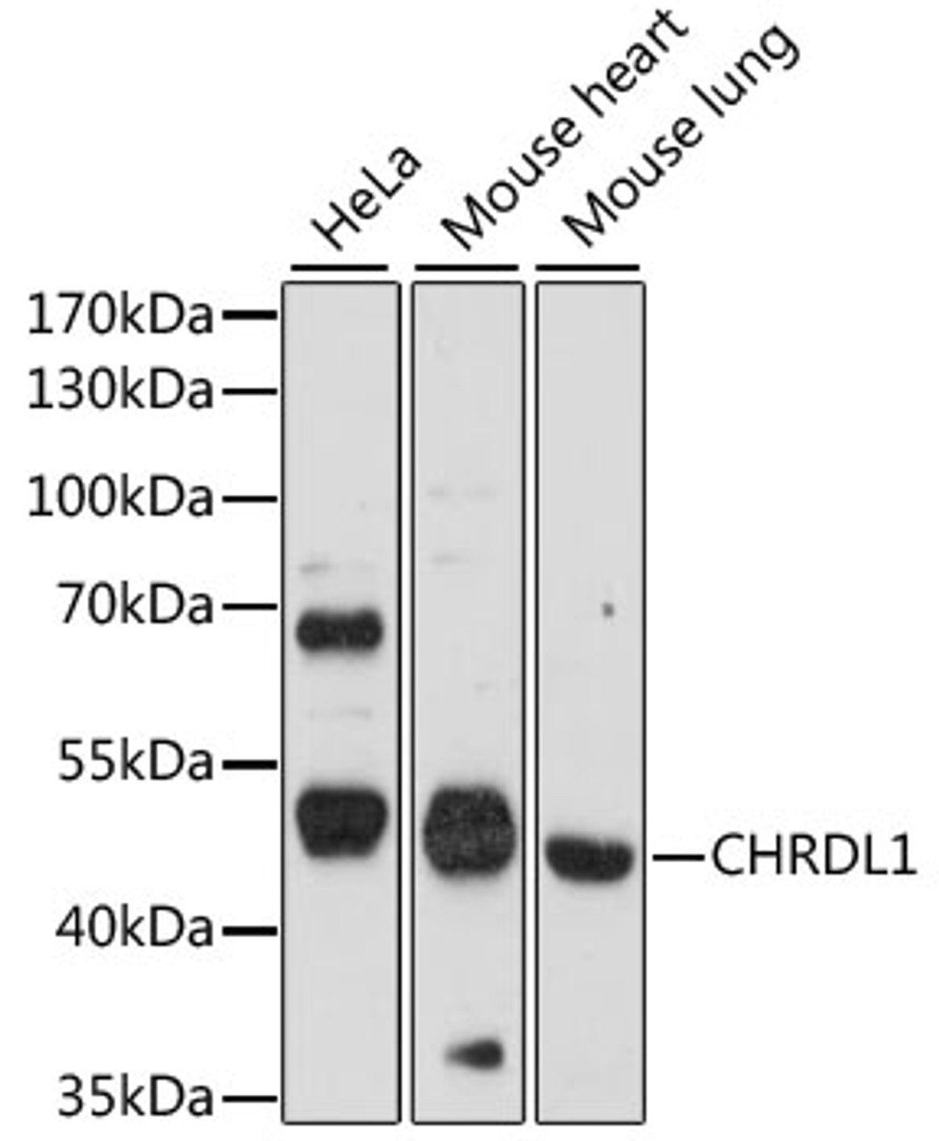 Western blot analysis of extracts of various cell lines, using CHRDL1 antibody (15-928) at 1:1000 dilution.<br/>Secondary antibody: HRP Goat Anti-Rabbit IgG (H+L) at 1:10000 dilution.<br/>Lysates/proteins: 25ug per lane.<br/>Blocking buffer: 3% nonfat dry milk in TBST.<br/>Detection: ECL Basic Kit.<br/>Exposure time: 90s.
