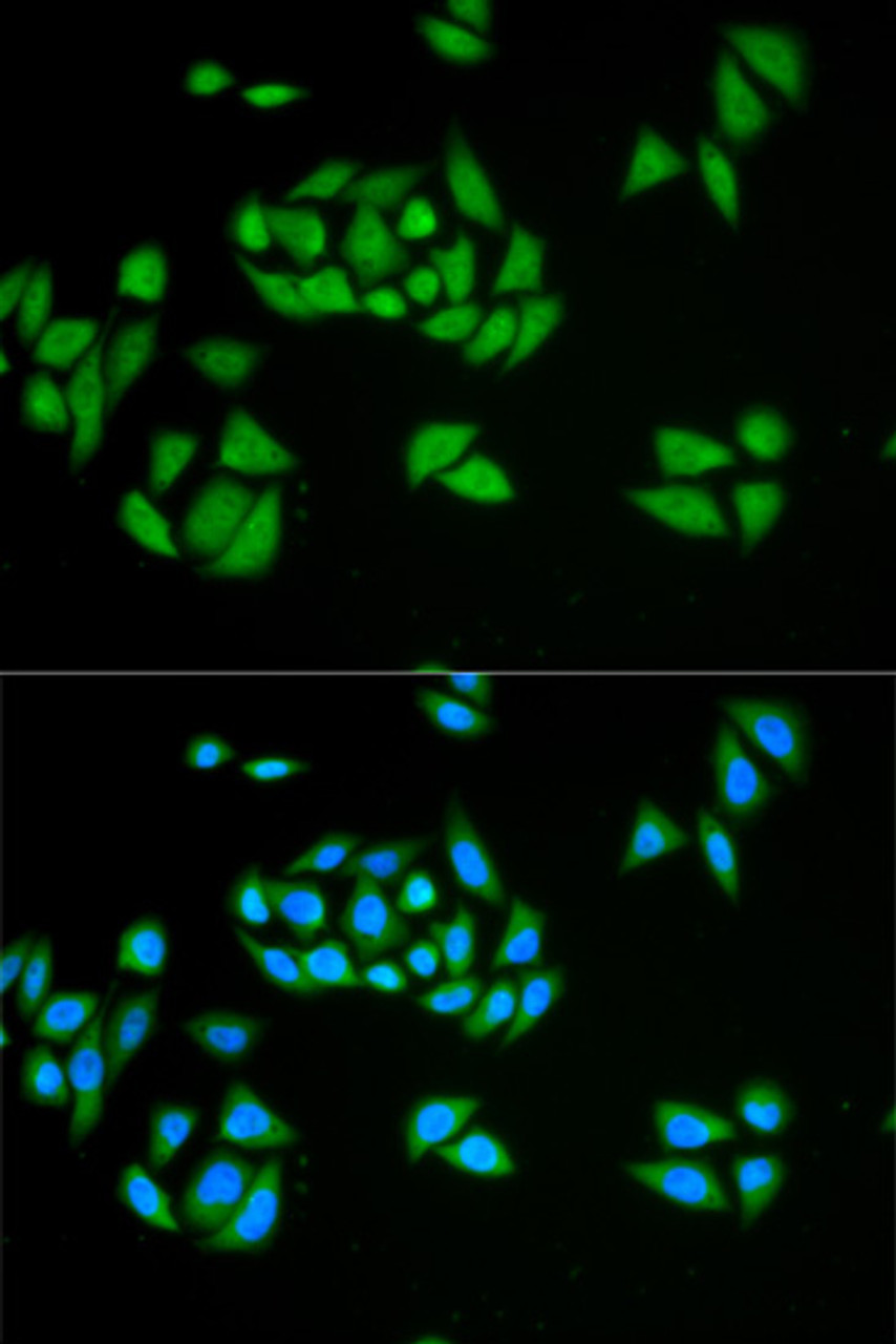 Immunofluorescence analysis of HeLa cells using UPF1 antibody (15-930) . Blue: DAPI for nuclear staining.