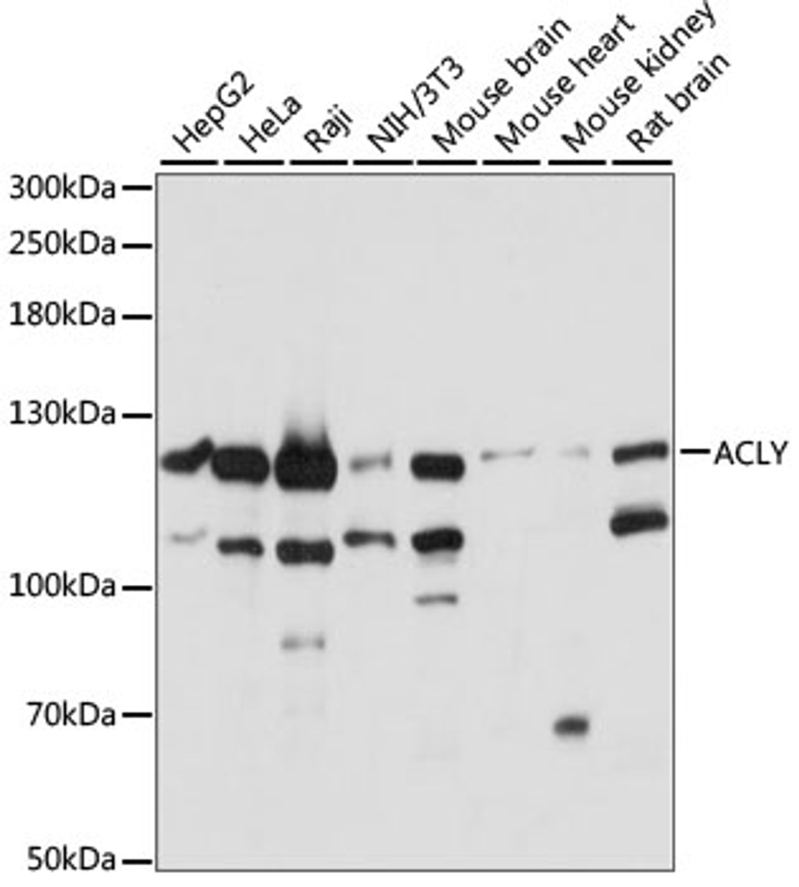 Western blot analysis of extracts of various cell lines, using ACLY antibody (15-947) at 1:1000 dilution.<br/>Secondary antibody: HRP Goat Anti-Rabbit IgG (H+L) at 1:10000 dilution.<br/>Lysates/proteins: 25ug per lane.<br/>Blocking buffer: 3% nonfat dry milk in TBST.<br/>Detection: ECL Basic Kit.<br/>Exposure time: 1S.