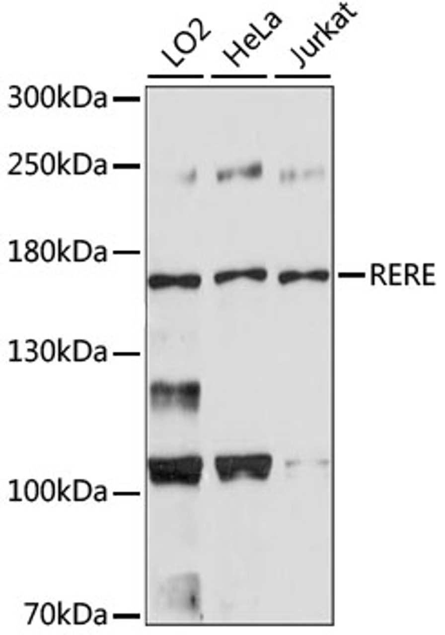 Western blot analysis of extracts of various cell lines, using RERE antibody (15-949) .<br/>Secondary antibody: HRP Goat Anti-Rabbit IgG (H+L) at 1:10000 dilution.<br/>Lysates/proteins: 25ug per lane.<br/>Blocking buffer: 3% nonfat dry milk in TBST.<br/>Detection: ECL Basic Kit.<br/>Exposure time: 90s.