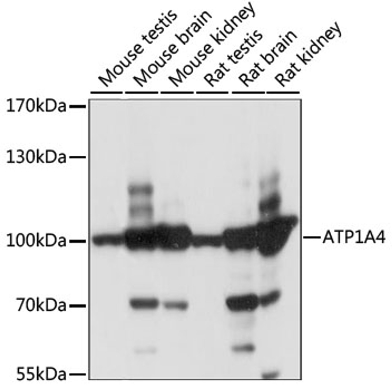 Western blot analysis of extracts of various cell lines, using ATP1A4 antibody (15-950) at 1:1000 dilution.<br/>Secondary antibody: HRP Goat Anti-Rabbit IgG (H+L) at 1:10000 dilution.<br/>Lysates/proteins: 25ug per lane.<br/>Blocking buffer: 3% nonfat dry milk in TBST.<br/>Detection: ECL Basic Kit.<br/>Exposure time: 1S.