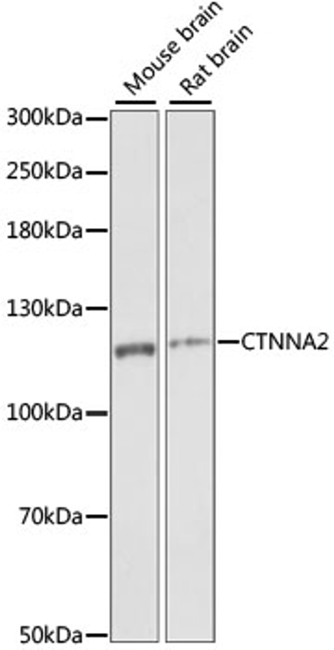 Western blot analysis of extracts of various cell lines, using CTNNA2 antibody (15-953) at 1:1000 dilution.<br/>Secondary antibody: HRP Goat Anti-Rabbit IgG (H+L) at 1:10000 dilution.<br/>Lysates/proteins: 25ug per lane.<br/>Blocking buffer: 3% nonfat dry milk in TBST.<br/>Detection: ECL Enhanced Kit.<br/>Exposure time: 1S.