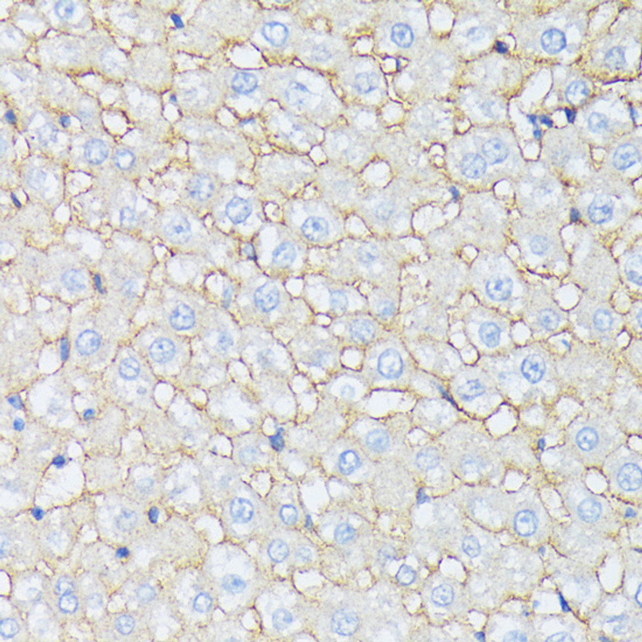 Immunohistochemistry of paraffin-embedded rat liver using CTNNA2 antibody (15-953) at dilution of 1:100 (40x lens) .