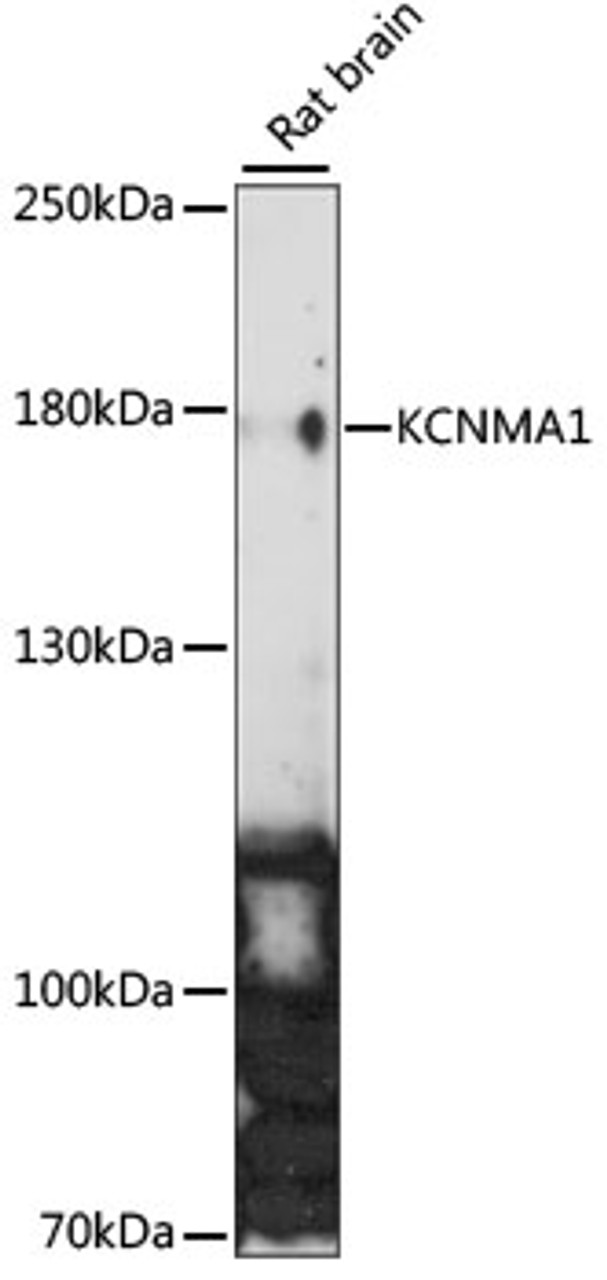 Western blot analysis of extracts of Rat brain, using KCNMA1 antibody (15-961) at 1:1000 dilution.<br/>Secondary antibody: HRP Goat Anti-Rabbit IgG (H+L) at 1:10000 dilution.<br/>Lysates/proteins: 25ug per lane.<br/>Blocking buffer: 3% nonfat dry milk in TBST.<br/>Detection: ECL Enhanced Kit.<br/>Exposure time: 90s.