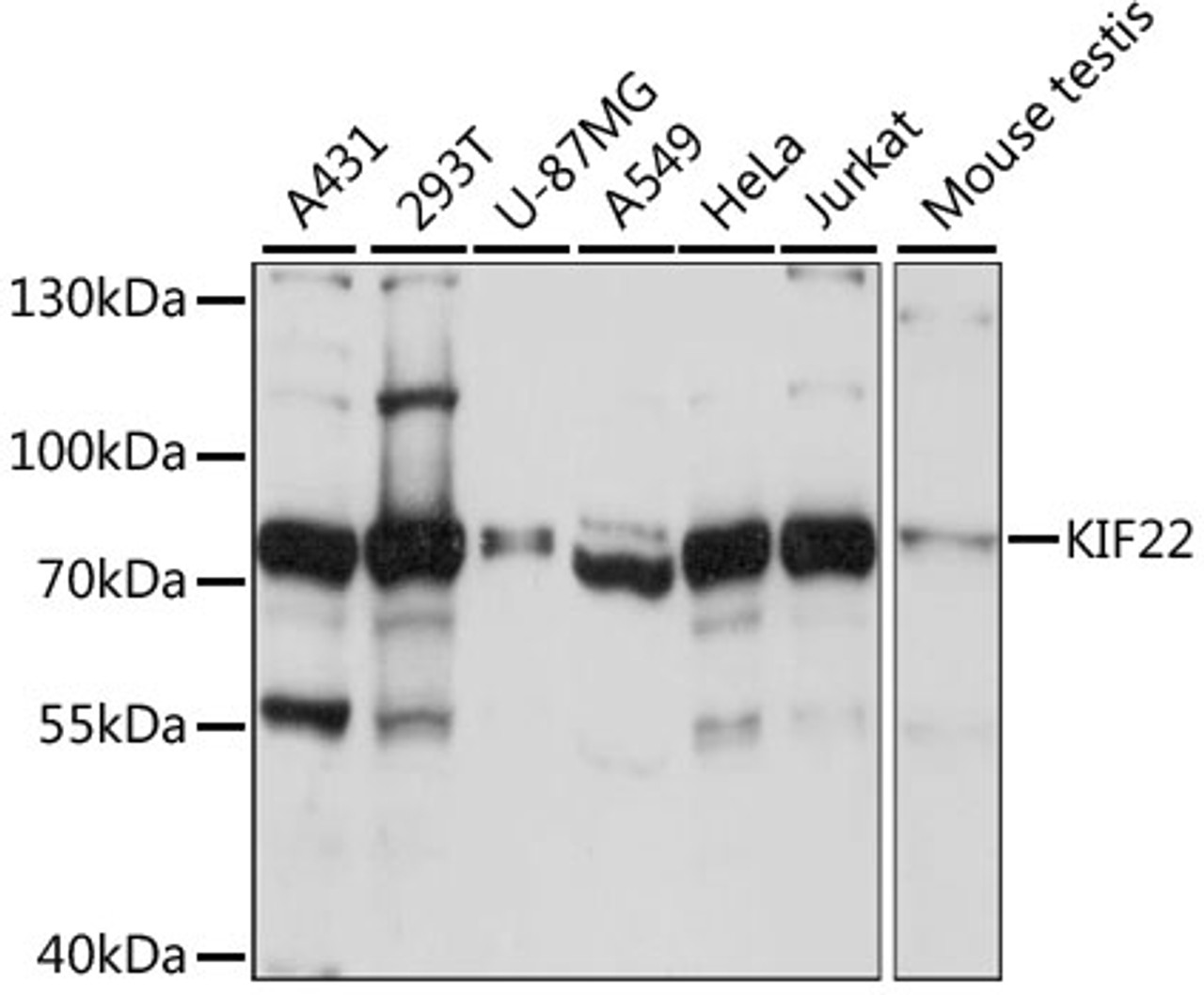 Western blot analysis of extracts of various cell lines, using KIF22 antibody (15-963) at 1:1000 dilution.<br/>Secondary antibody: HRP Goat Anti-Rabbit IgG (H+L) at 1:10000 dilution.<br/>Lysates/proteins: 25ug per lane.<br/>Blocking buffer: 3% nonfat dry milk in TBST.<br/>Detection: ECL Basic Kit.<br/>Exposure time: 3s.
