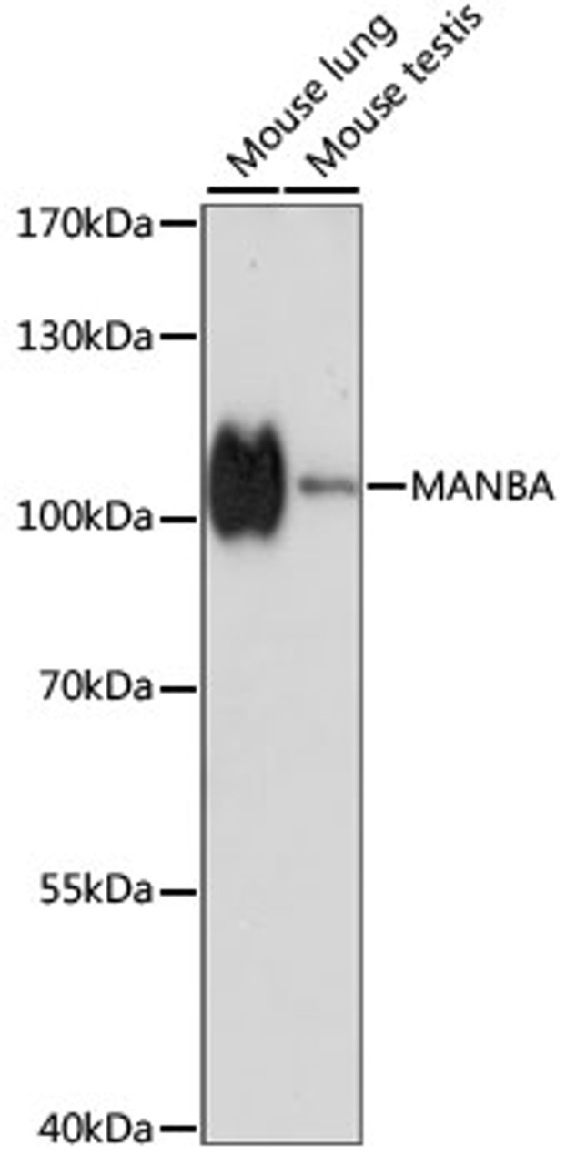 Western blot analysis of extracts of various cell lines, using MANBA antibody (15-965) at 1:1000 dilution.<br/>Secondary antibody: HRP Goat Anti-Rabbit IgG (H+L) at 1:10000 dilution.<br/>Lysates/proteins: 25ug per lane.<br/>Blocking buffer: 3% nonfat dry milk in TBST.<br/>Detection: ECL Basic Kit.<br/>Exposure time: 30s.