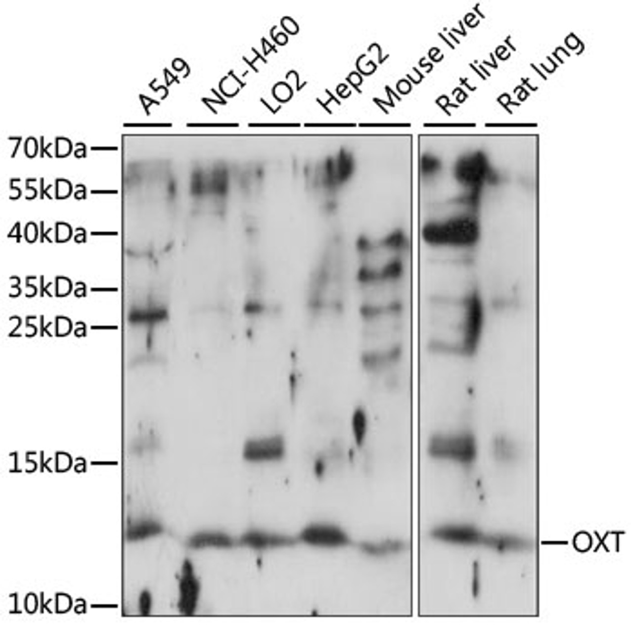 Western blot analysis of extracts of various cell lines, using OXT antibody (15-970) at 1:1000 dilution.<br/>Secondary antibody: HRP Goat Anti-Rabbit IgG (H+L) at 1:10000 dilution.<br/>Lysates/proteins: 25ug per lane.<br/>Blocking buffer: 3% nonfat dry milk in TBST.<br/>Detection: ECL Basic Kit.<br/>Exposure time: 30s.