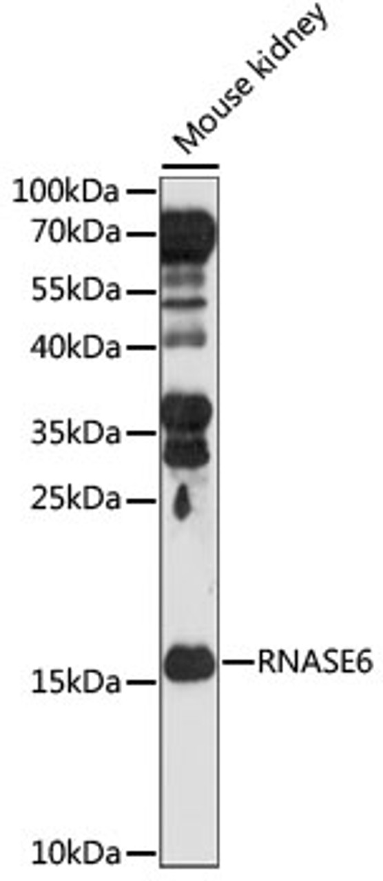 Western blot analysis of extracts of Mouse kidney, using RNASE6 antibody (15-983) at 1:1000 dilution.<br/>Secondary antibody: HRP Goat Anti-Rabbit IgG (H+L) at 1:10000 dilution.<br/>Lysates/proteins: 25ug per lane.<br/>Blocking buffer: 3% nonfat dry milk in TBST.<br/>Detection: ECL Basic Kit.<br/>Exposure time: 90s.