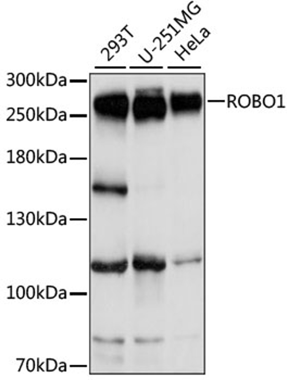 Western blot analysis of extracts of various cell lines, using ROBO1 antibody (15-984) at 1:1000 dilution.<br/>Secondary antibody: HRP Goat Anti-Rabbit IgG (H+L) at 1:10000 dilution.<br/>Lysates/proteins: 25ug per lane.<br/>Blocking buffer: 3% nonfat dry milk in TBST.<br/>Detection: ECL Basic Kit.<br/>Exposure time: 3s.