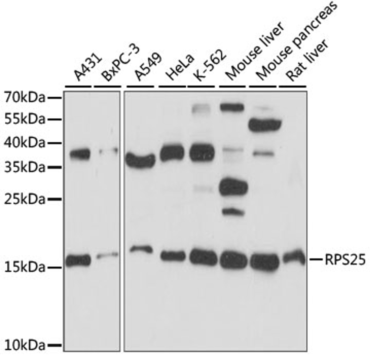 Western blot analysis of extracts of various cell lines, using RPS25 antibody (15-985) at 1:1000 dilution.<br/>Secondary antibody: HRP Goat Anti-Rabbit IgG (H+L) at 1:10000 dilution.<br/>Lysates/proteins: 25ug per lane.<br/>Blocking buffer: 3% nonfat dry milk in TBST.<br/>Detection: ECL Basic Kit.<br/>Exposure time: 15s.