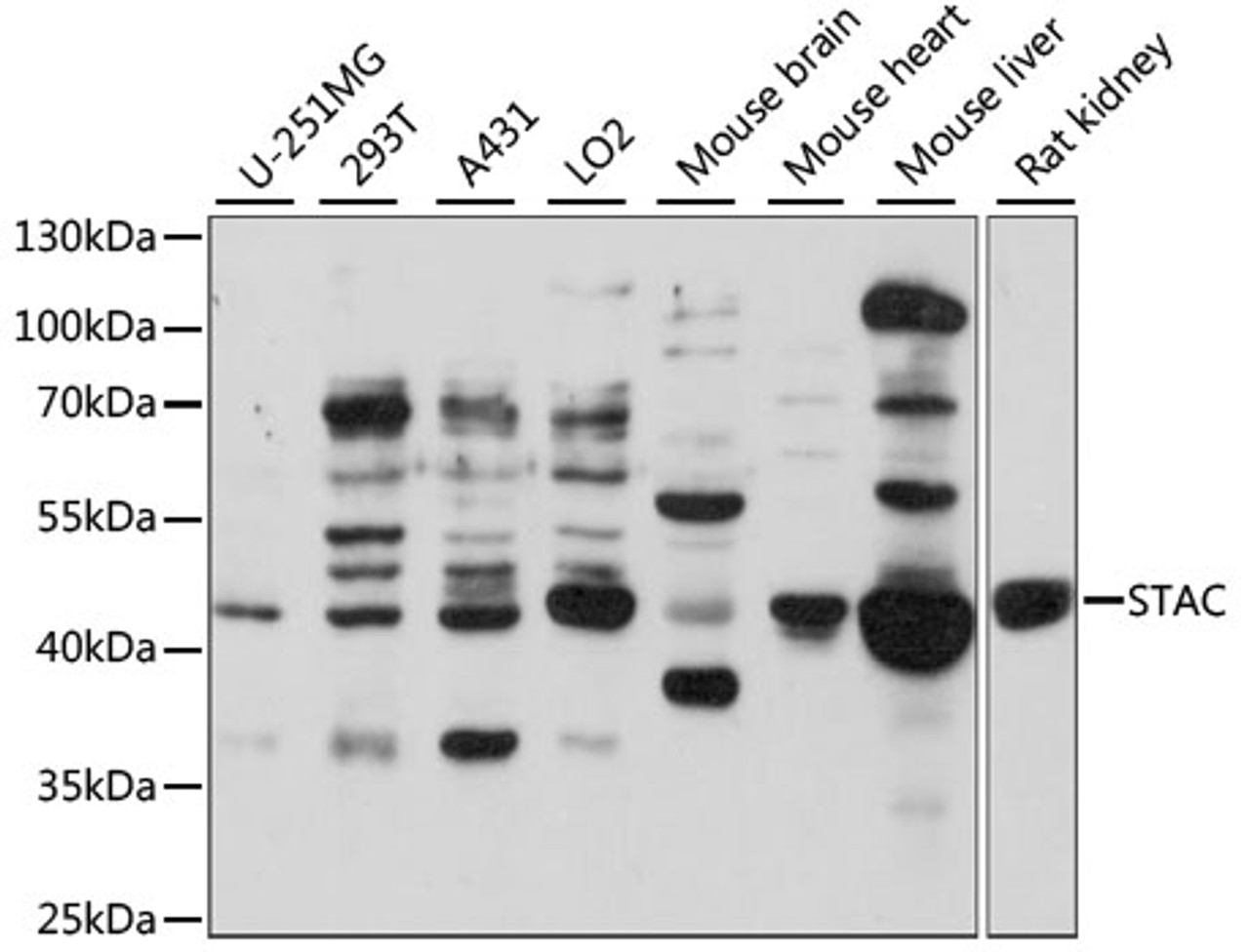 Western blot analysis of extracts of various cell lines, using STAC antibody (15-988) at 1:1000 dilution.<br/>Secondary antibody: HRP Goat Anti-Rabbit IgG (H+L) at 1:10000 dilution.<br/>Lysates/proteins: 25ug per lane.<br/>Blocking buffer: 3% nonfat dry milk in TBST.<br/>Detection: ECL Basic Kit.<br/>Exposure time: 90s.