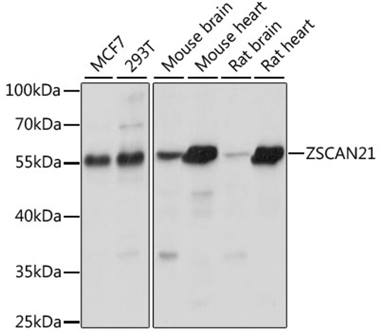 Western blot analysis of extracts of various cell lines, using ZSCAN21 antibody (15-992) at 1:1000 dilution.<br/>Secondary antibody: HRP Goat Anti-Rabbit IgG (H+L) at 1:10000 dilution.<br/>Lysates/proteins: 25ug per lane.<br/>Blocking buffer: 3% nonfat dry milk in TBST.<br/>Detection: ECL Basic Kit.<br/>Exposure time: 10s.