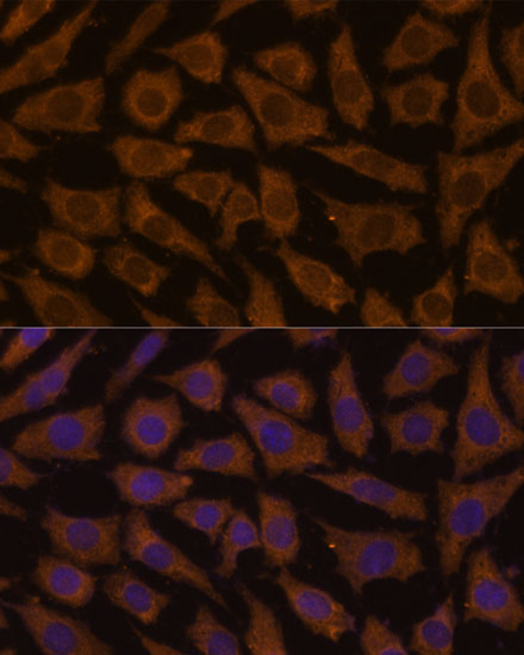 Immunofluorescence analysis of L929 cells using MTMR4 Polyclonal Antibody (16-006) at dilution of 1:100 (40x lens) . Blue: DAPI for nuclear staining.