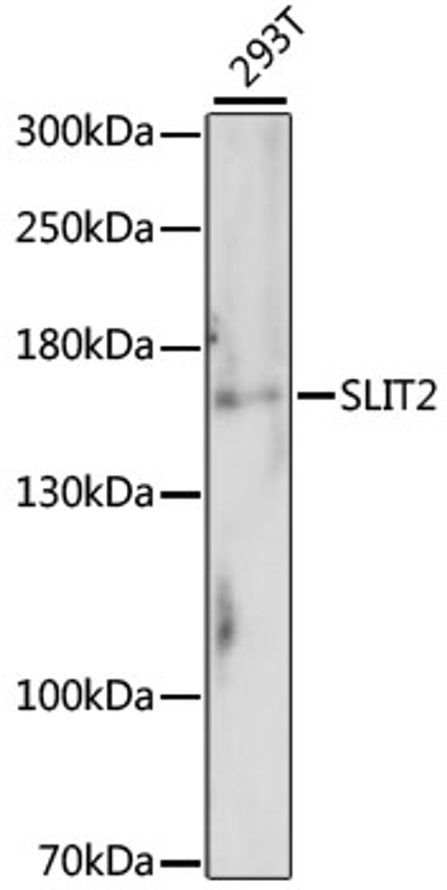 Western blot analysis of extracts of 293T cells, using SLIT2 antibody (16-009) .<br/>Secondary antibody: HRP Goat Anti-Rabbit IgG (H+L) at 1:10000 dilution.<br/>Lysates/proteins: 25ug per lane.<br/>Blocking buffer: 3% nonfat dry milk in TBST.<br/>Detection: ECL Basic Kit.<br/>Exposure time: 90s.