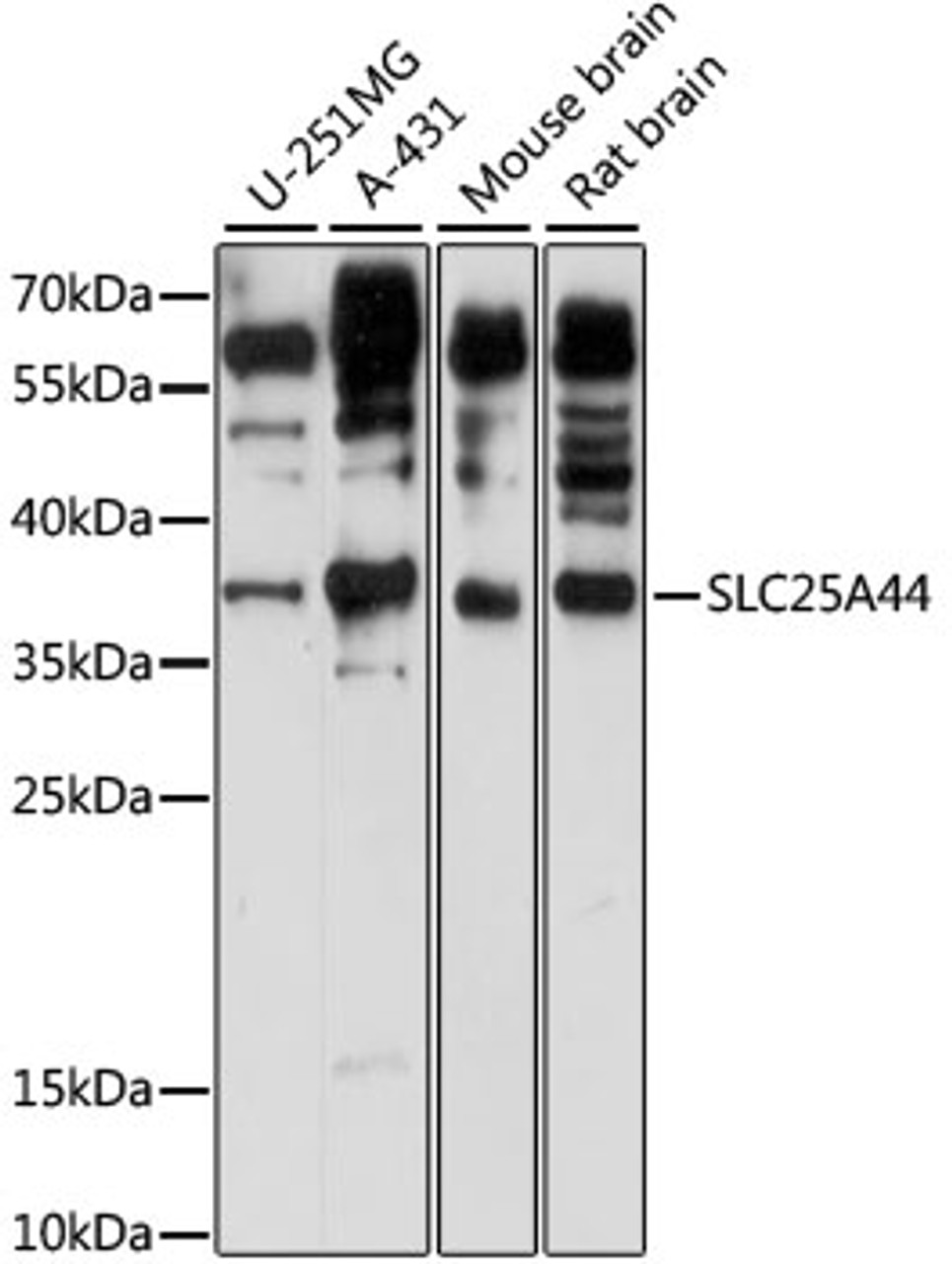 Western blot analysis of extracts of various cell lines, using SLC25A44 antibody (16-014) at 1:1000 dilution.<br/>Secondary antibody: HRP Goat Anti-Rabbit IgG (H+L) at 1:10000 dilution.<br/>Lysates/proteins: 25ug per lane.<br/>Blocking buffer: 3% nonfat dry milk in TBST.<br/>Detection: ECL Basic Kit.<br/>Exposure time: 30s.