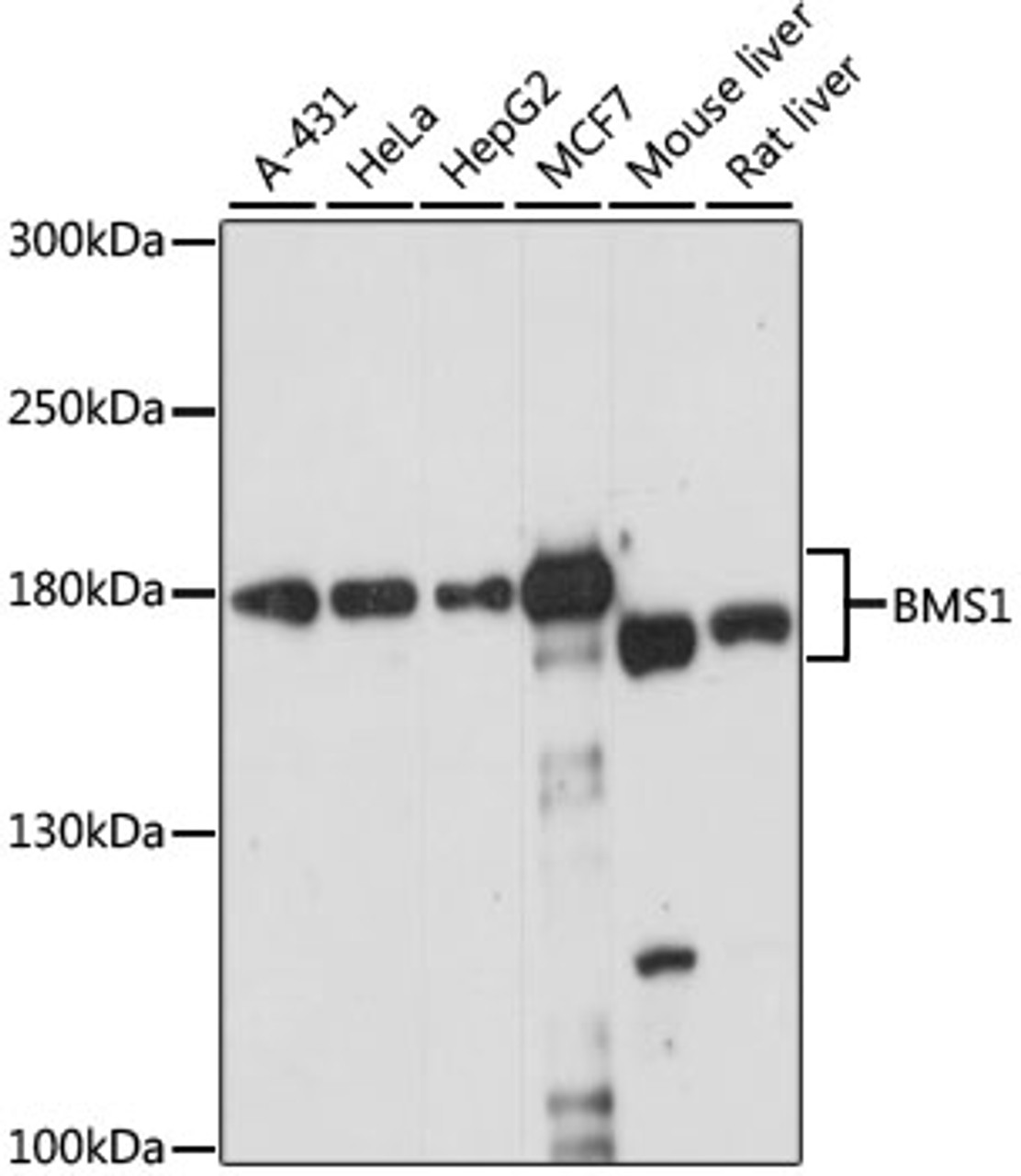 Western blot analysis of extracts of various cell lines, using BMS1 antibody (16-016) at 1:1000 dilution.<br/>Secondary antibody: HRP Goat Anti-Rabbit IgG (H+L) at 1:10000 dilution.<br/>Lysates/proteins: 25ug per lane.<br/>Blocking buffer: 3% nonfat dry milk in TBST.<br/>Detection: ECL Enhanced Kit.<br/>Exposure time: 15s.