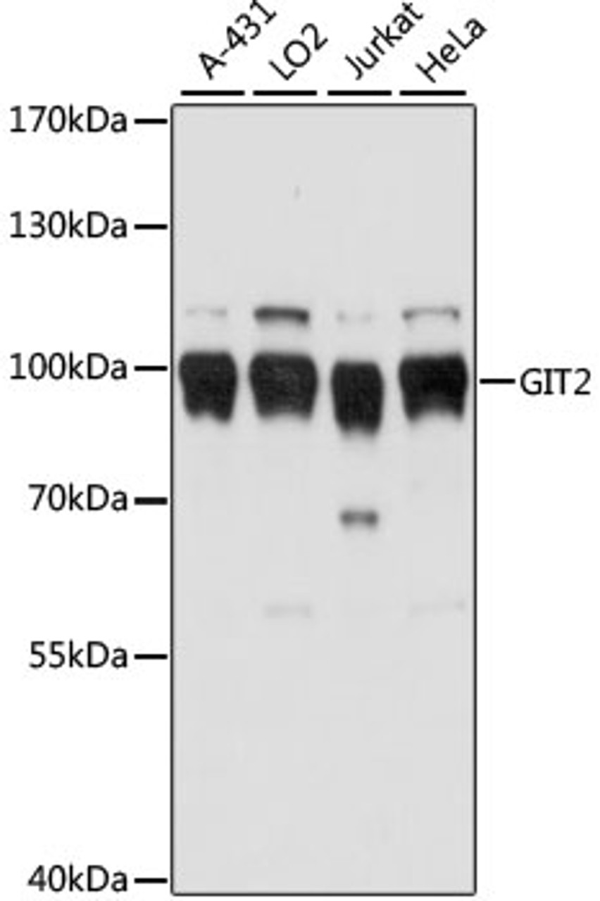 Western blot analysis of extracts of various cell lines, using GIT2 antibody (16-017) at 1:1000 dilution.<br/>Secondary antibody: HRP Goat Anti-Rabbit IgG (H+L) at 1:10000 dilution.<br/>Lysates/proteins: 25ug per lane.<br/>Blocking buffer: 3% nonfat dry milk in TBST.<br/>Detection: ECL Basic Kit.<br/>Exposure time: 1s.