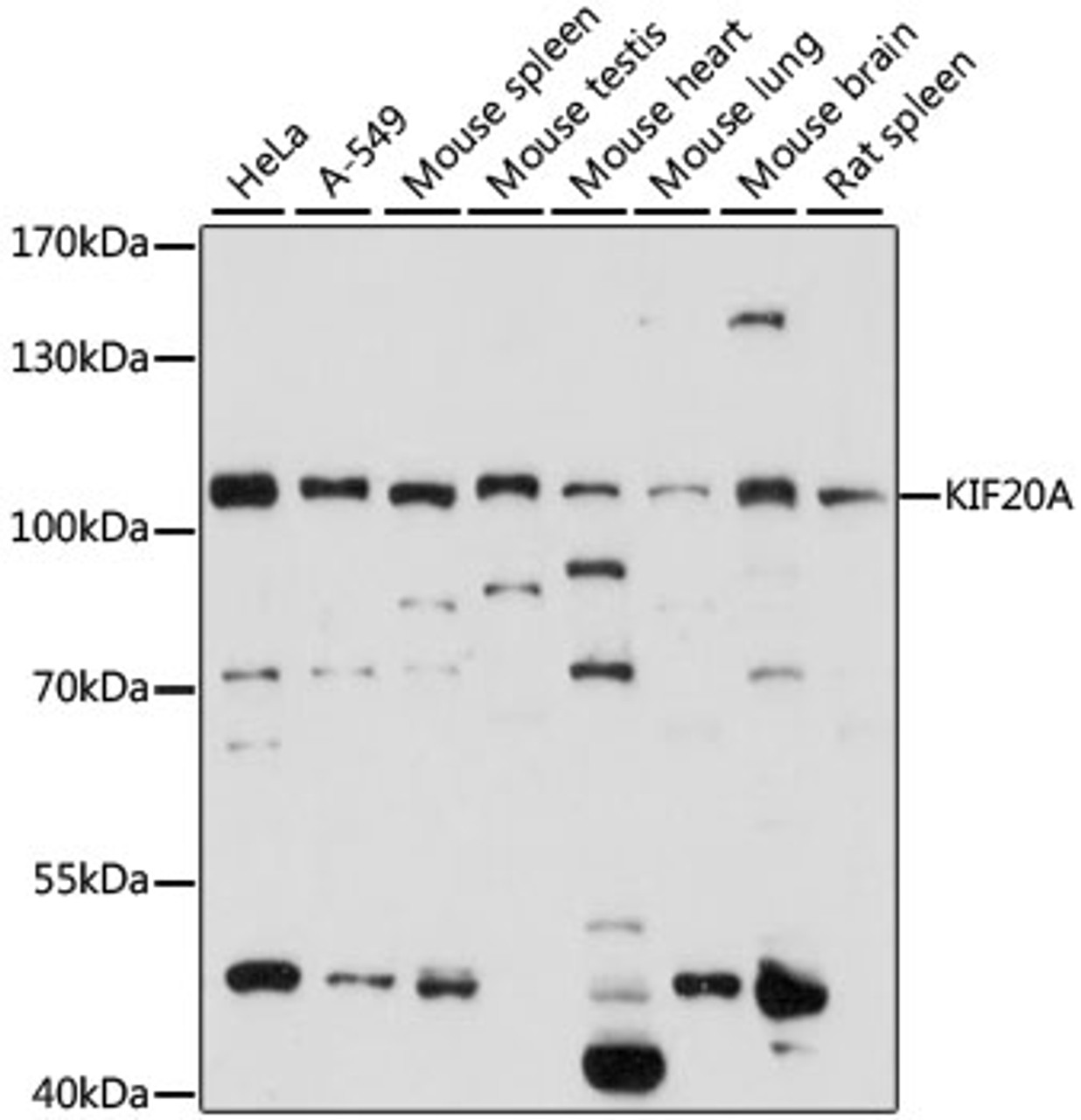 Western blot analysis of extracts of various cell lines, using KIF20A antibody (16-020) at 1:1000 dilution.<br/>Secondary antibody: HRP Goat Anti-Rabbit IgG (H+L) at 1:10000 dilution.<br/>Lysates/proteins: 25ug per lane.<br/>Blocking buffer: 3% nonfat dry milk in TBST.<br/>Detection: ECL Basic Kit.<br/>Exposure time: 15s.