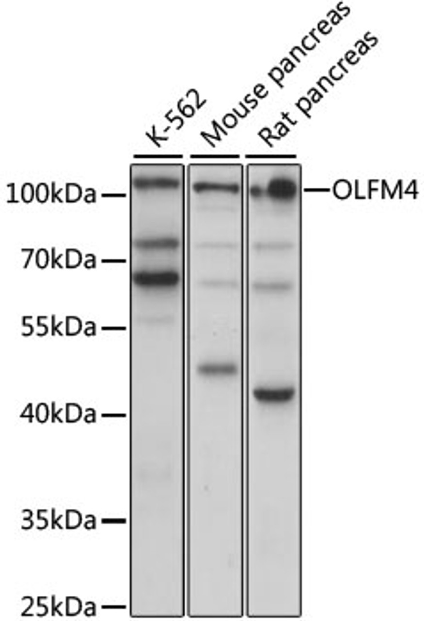 Western blot analysis of extracts of various cell lines, using OLFM4 antibody (16-026) at 1:1000 dilution.<br/>Secondary antibody: HRP Goat Anti-Rabbit IgG (H+L) at 1:10000 dilution.<br/>Lysates/proteins: 25ug per lane.<br/>Blocking buffer: 3% nonfat dry milk in TBST.<br/>Detection: ECL Basic Kit.<br/>Exposure time: 30s.