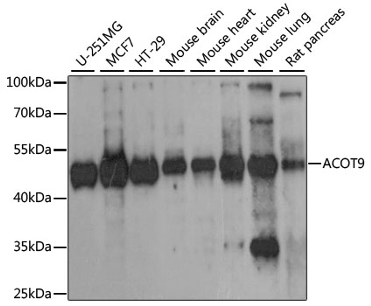 Western blot analysis of extracts of various cell lines, using ACOT9 antibody (16-037) at 1:1000 dilution.<br/>Secondary antibody: HRP Goat Anti-Rabbit IgG (H+L) at 1:10000 dilution.<br/>Lysates/proteins: 25ug per lane.<br/>Blocking buffer: 3% nonfat dry milk in TBST.<br/>Detection: ECL Basic Kit.<br/>Exposure time: 30s.