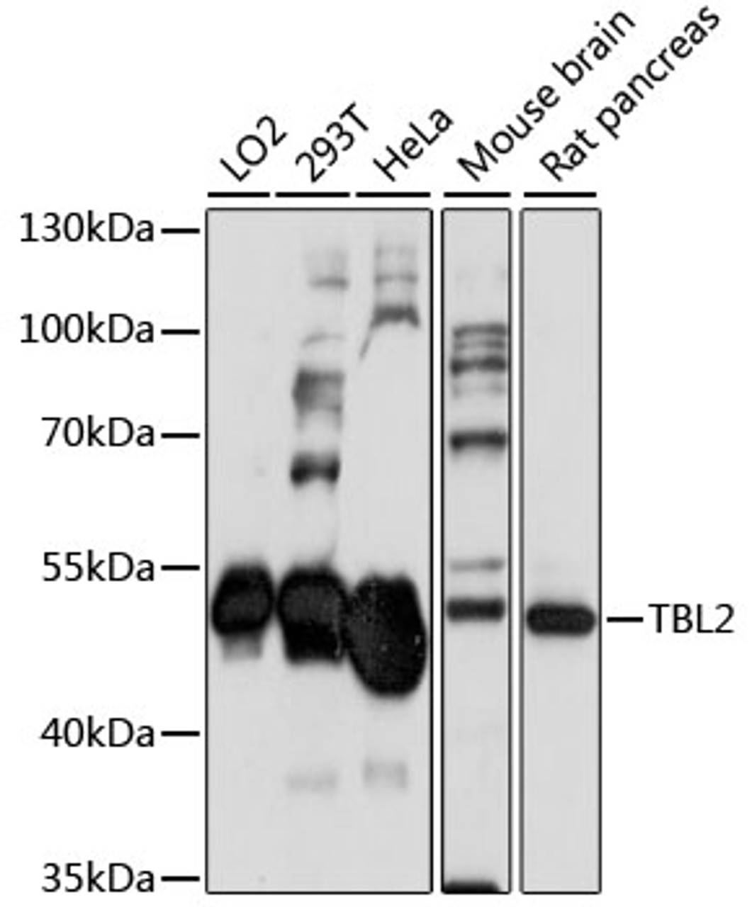 Western blot analysis of extracts of various cell lines, using TBL2 antibody (16-044) at 1:1000 dilution.<br/>Secondary antibody: HRP Goat Anti-Rabbit IgG (H+L) at 1:10000 dilution.<br/>Lysates/proteins: 25ug per lane.<br/>Blocking buffer: 3% nonfat dry milk in TBST.<br/>Detection: ECL Enhanced Kit.<br/>Exposure time: 90s.