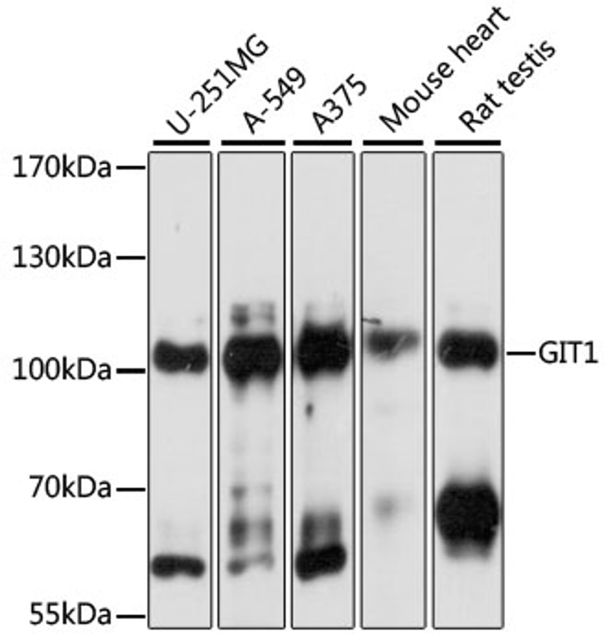 Western blot analysis of extracts of various cell lines, using GIT1 antibody (16-047) at 1:1000 dilution.<br/>Secondary antibody: HRP Goat Anti-Rabbit IgG (H+L) at 1:10000 dilution.<br/>Lysates/proteins: 25ug per lane.<br/>Blocking buffer: 3% nonfat dry milk in TBST.<br/>Detection: ECL Basic Kit.<br/>Exposure time: 1s.