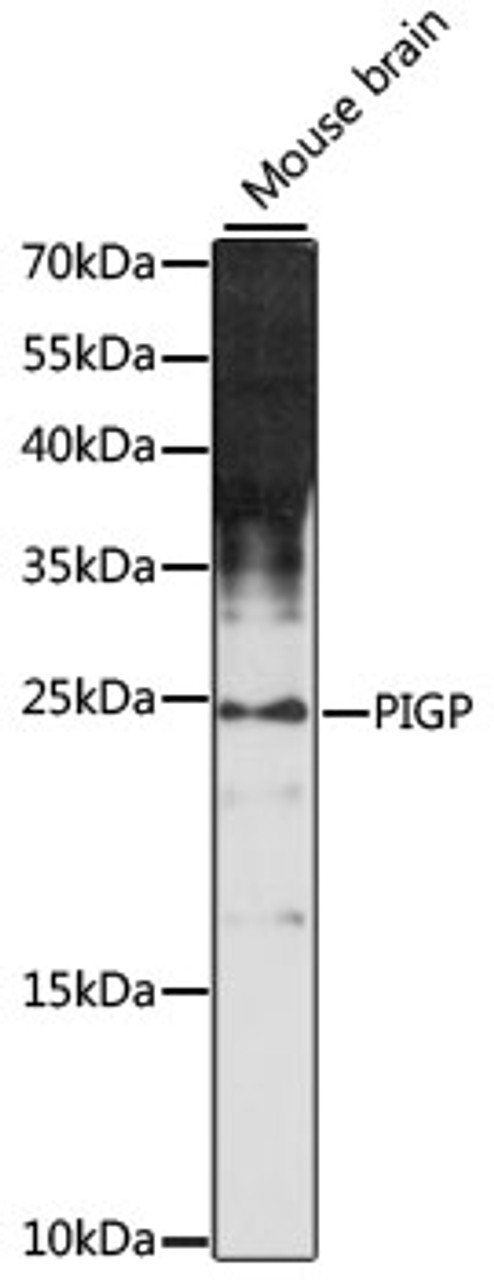 Western blot analysis of extracts of mouse brain, using PIGP antibody (16-050) at 1:1000 dilution.<br/>Secondary antibody: HRP Goat Anti-Rabbit IgG (H+L) at 1:10000 dilution.<br/>Lysates/proteins: 25ug per lane.<br/>Blocking buffer: 3% nonfat dry milk in TBST.<br/>Detection: ECL Enhanced Kit.<br/>Exposure time: 90s.