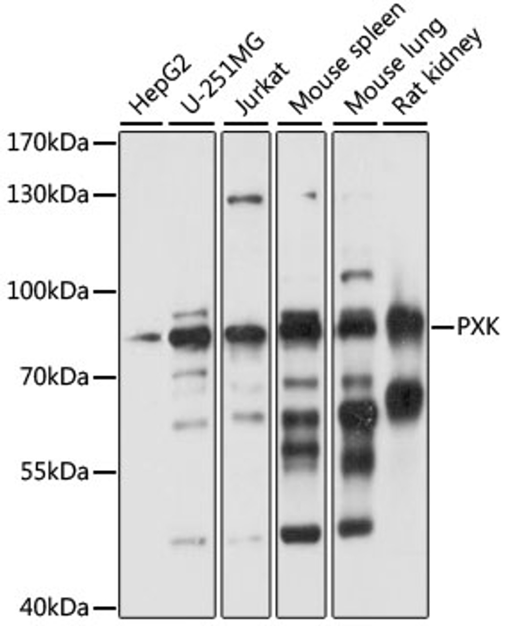 Western blot analysis of extracts of various cell lines, using PXK antibody (16-054) at 1:1000 dilution.<br/>Secondary antibody: HRP Goat Anti-Rabbit IgG (H+L) at 1:10000 dilution.<br/>Lysates/proteins: 25ug per lane.<br/>Blocking buffer: 3% nonfat dry milk in TBST.<br/>Detection: ECL Basic Kit.<br/>Exposure time: 10s.
