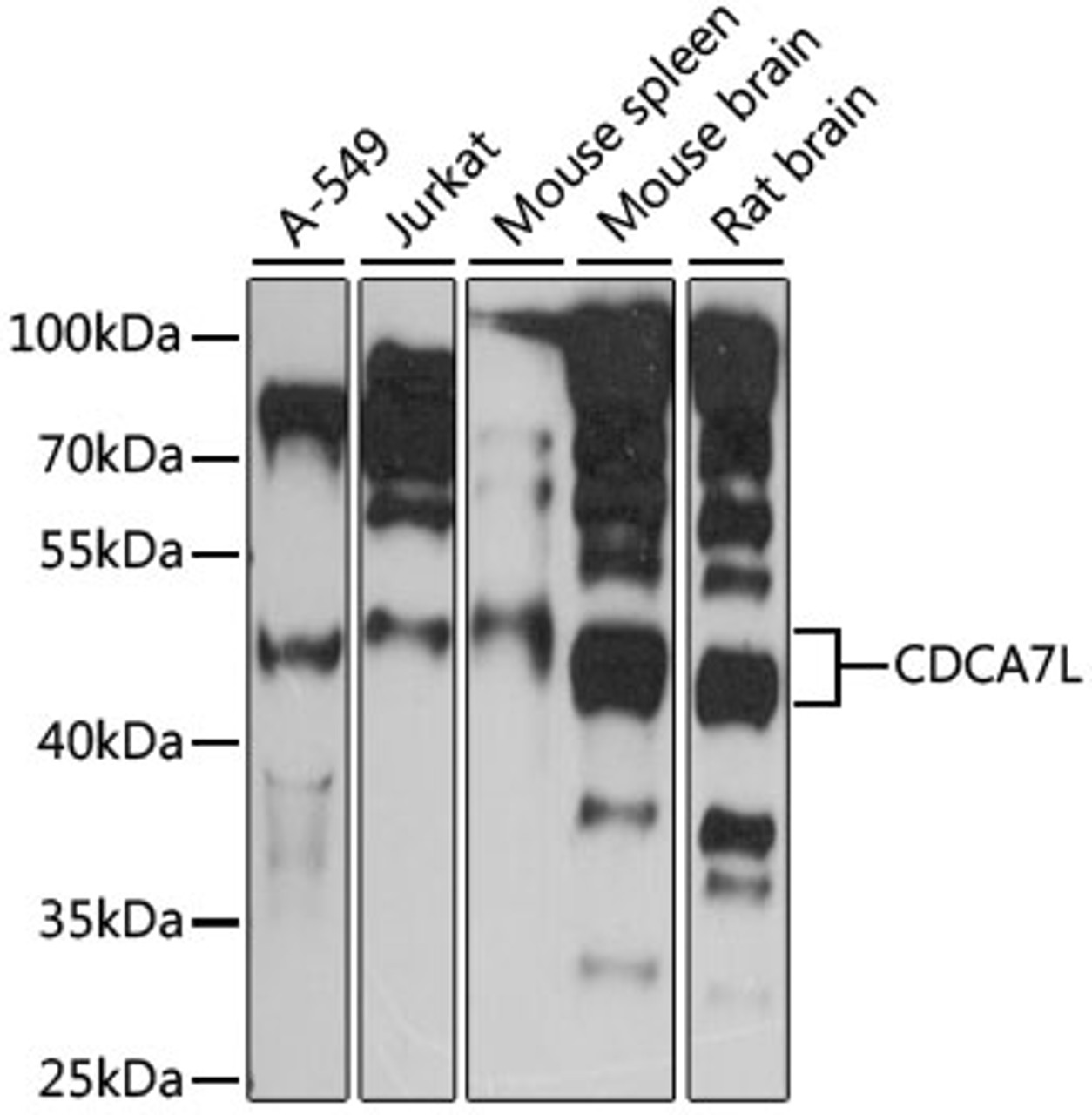 Western blot analysis of extracts of various cell lines, using CDCA7L antibody (16-060) at 1:1000 dilution.<br/>Secondary antibody: HRP Goat Anti-Rabbit IgG (H+L) at 1:10000 dilution.<br/>Lysates/proteins: 25ug per lane.<br/>Blocking buffer: 3% nonfat dry milk in TBST.<br/>Detection: ECL Basic Kit.<br/>Exposure time: 90s.
