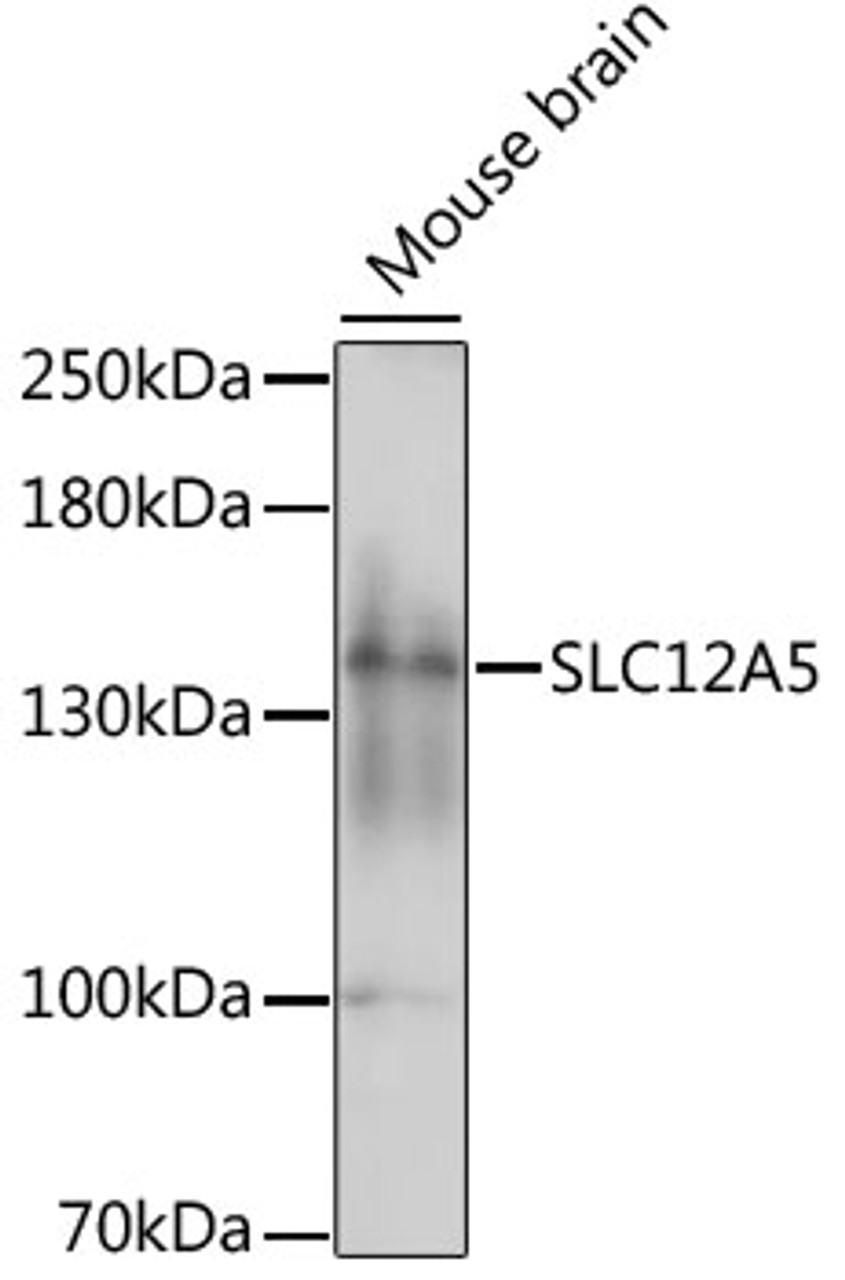 Western blot analysis of extracts of mouse brain, using SLC12A5 antibody (16-068) at 1:1000 dilution.<br/>Secondary antibody: HRP Goat Anti-Rabbit IgG (H+L) at 1:10000 dilution.<br/>Lysates/proteins: 25ug per lane.<br/>Blocking buffer: 3% nonfat dry milk in TBST.<br/>Detection: ECL Basic Kit.<br/>Exposure time: 60s.