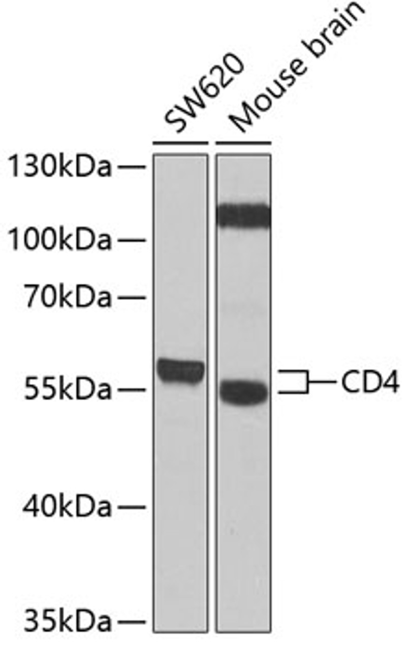 Western blot analysis of extracts of various cell lines, using CD4 antibody (16-070) at 1:1000 dilution.<br/>Secondary antibody: HRP Goat Anti-Rabbit IgG (H+L) at 1:10000 dilution.<br/>Lysates/proteins: 25ug per lane.<br/>Blocking buffer: 3% nonfat dry milk in TBST.<br/>Detection: ECL Enhanced Kit.<br/>Exposure time: 30s.