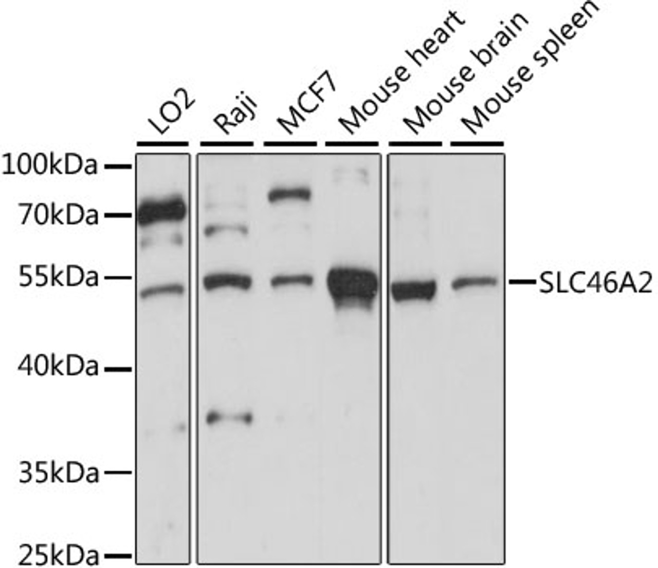 Western blot analysis of extracts of various cell lines, using SLC46A2 antibody (16-073) at 1:1000 dilution.<br/>Secondary antibody: HRP Goat Anti-Rabbit IgG (H+L) at 1:10000 dilution.<br/>Lysates/proteins: 25ug per lane.<br/>Blocking buffer: 3% nonfat dry milk in TBST.<br/>Detection: ECL Basic Kit.<br/>Exposure time: 30s.