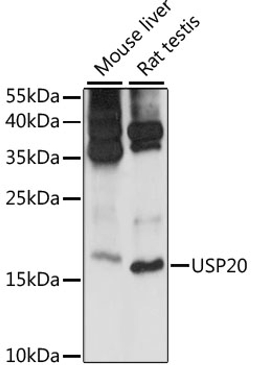 Western blot analysis of extracts of various cell lines, using MRPS14 antibody (16-077) at 1:1000 dilution.<br/>Secondary antibody: HRP Goat Anti-Rabbit IgG (H+L) at 1:10000 dilution.<br/>Lysates/proteins: 25ug per lane.<br/>Blocking buffer: 3% nonfat dry milk in TBST.<br/>Detection: ECL Basic Kit.<br/>Exposure time: 30s.