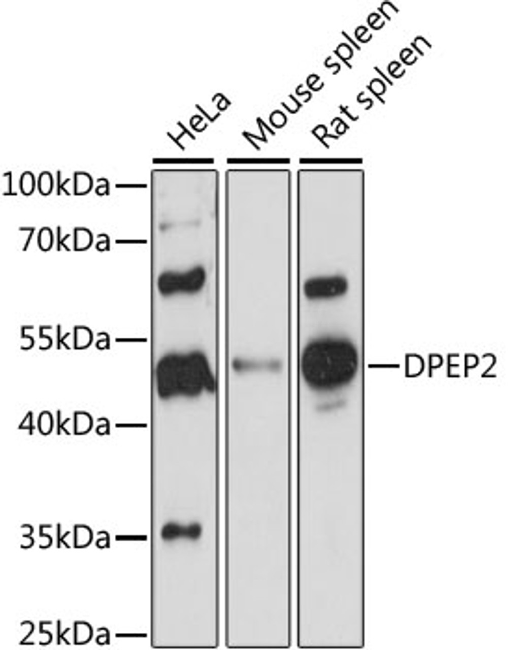 Western blot analysis of extracts of various cell lines, using DPEP2 antibody (16-079) at 1:1000 dilution.<br/>Secondary antibody: HRP Goat Anti-Rabbit IgG (H+L) at 1:10000 dilution.<br/>Lysates/proteins: 25ug per lane.<br/>Blocking buffer: 3% nonfat dry milk in TBST.<br/>Detection: ECL Basic Kit.<br/>Exposure time: 90s.