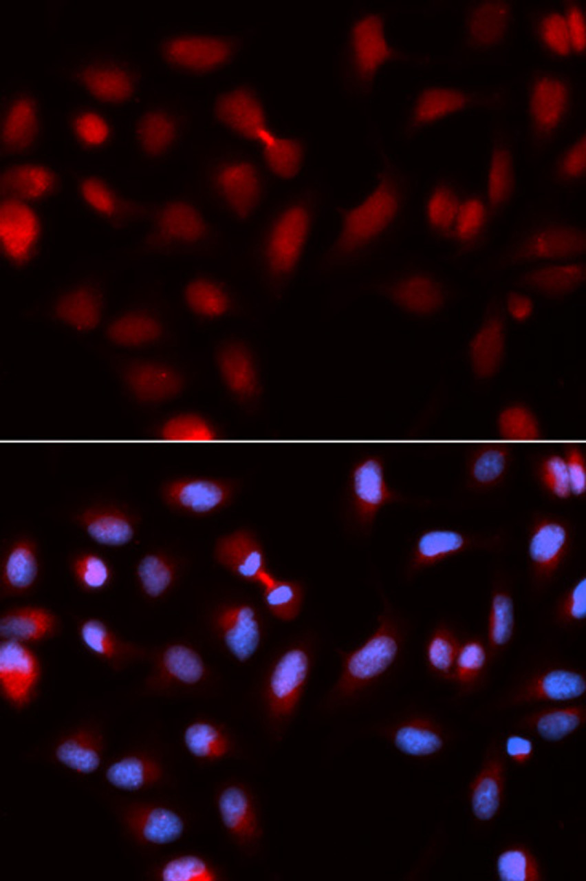 Immunofluorescence analysis of U2OS cells using Survivin antibody (16-083) . Blue: DAPI for nuclear staining.