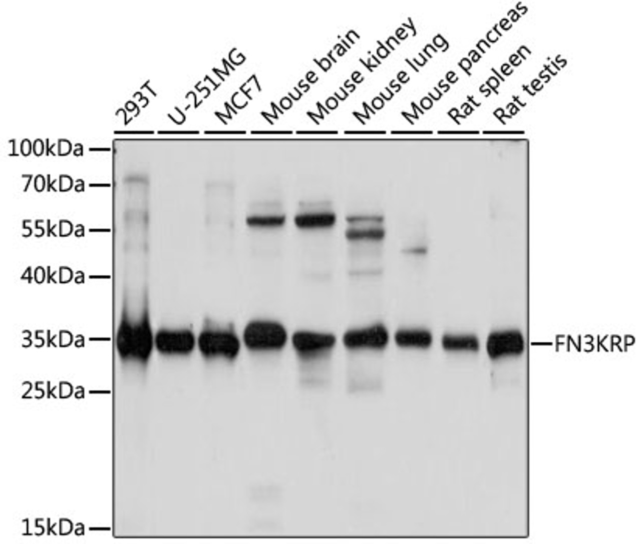 Western blot analysis of extracts of various cell lines, using FN3KRP antibody (16-085) at 1:1000 dilution.<br/>Secondary antibody: HRP Goat Anti-Rabbit IgG (H+L) at 1:10000 dilution.<br/>Lysates/proteins: 25ug per lane.<br/>Blocking buffer: 3% nonfat dry milk in TBST.<br/>Detection: ECL Basic Kit.<br/>Exposure time: 5s.