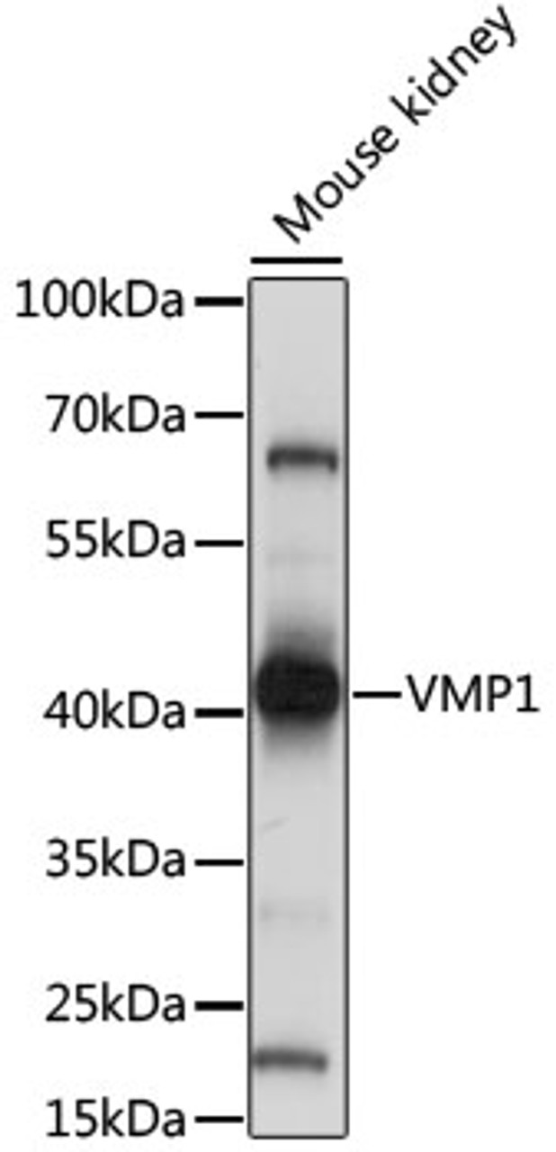 Western blot analysis of extracts of mouse kidney, using VMP1 antibody (16-089) at 1:1000 dilution.<br/>Secondary antibody: HRP Goat Anti-Rabbit IgG (H+L) at 1:10000 dilution.<br/>Lysates/proteins: 25ug per lane.<br/>Blocking buffer: 3% nonfat dry milk in TBST.<br/>Detection: ECL Basic Kit.<br/>Exposure time: 5s.
