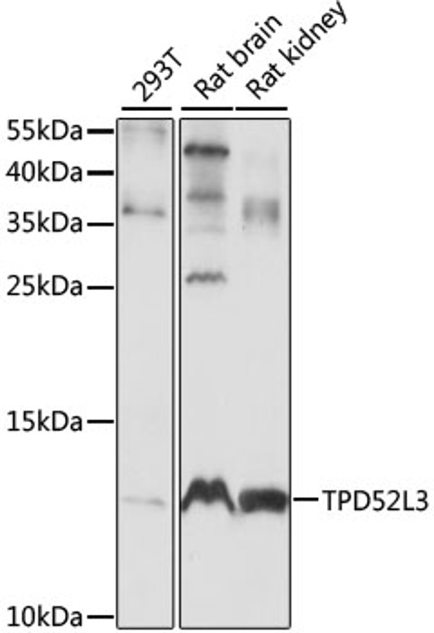 Western blot analysis of extracts of various cell lines, using TPD52L3 antibody (16-099) at 1:1000 dilution.<br/>Secondary antibody: HRP Goat Anti-Rabbit IgG (H+L) at 1:10000 dilution.<br/>Lysates/proteins: 25ug per lane.<br/>Blocking buffer: 3% nonfat dry milk in TBST.<br/>Detection: ECL Basic Kit.<br/>Exposure time: 10S.