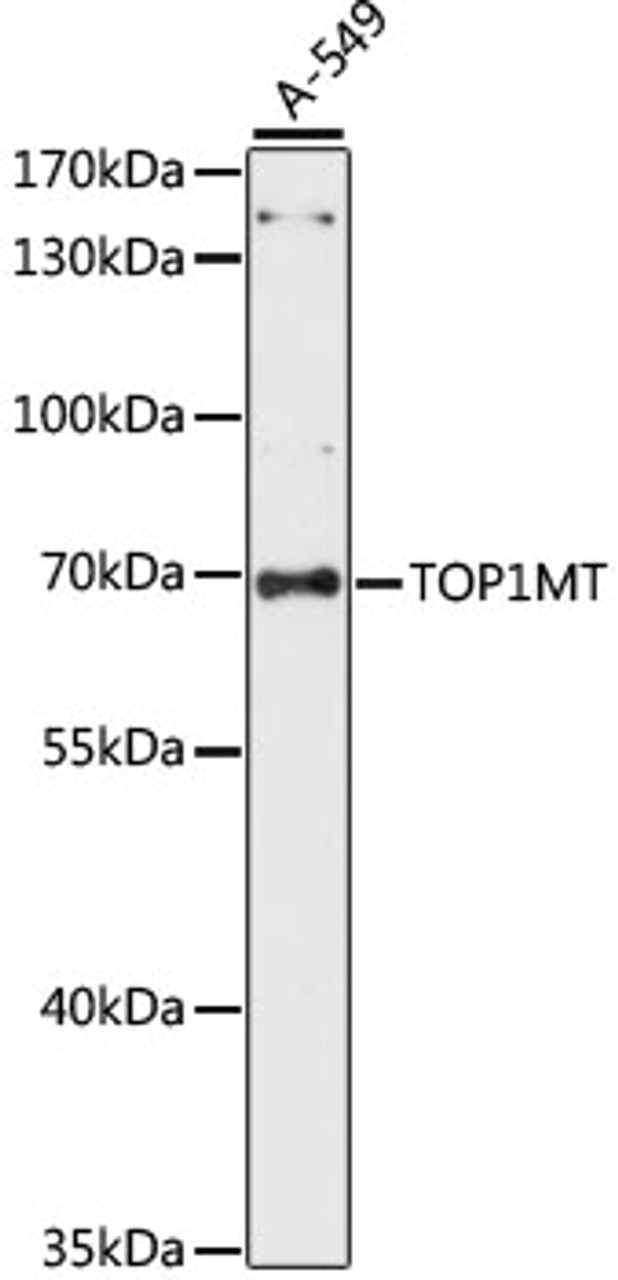 Western blot analysis of extracts of A-549 cells, using TOP1MT antibody (16-110) at 1:1000 dilution.<br/>Secondary antibody: HRP Goat Anti-Rabbit IgG (H+L) at 1:10000 dilution.<br/>Lysates/proteins: 25ug per lane.<br/>Blocking buffer: 3% nonfat dry milk in TBST.<br/>Detection: ECL Basic Kit.<br/>Exposure time: 60S.