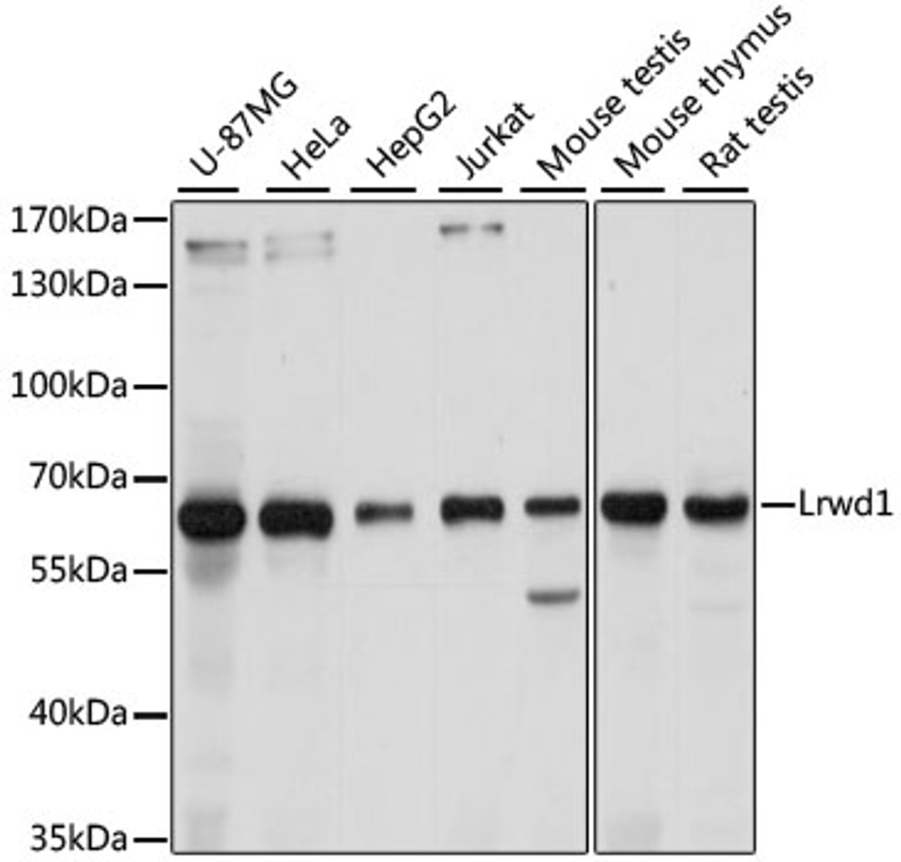 Western blot analysis of extracts of various cell lines, using Lrwd1 antibody (16-117) at 1:1000 dilution.<br/>Secondary antibody: HRP Goat Anti-Rabbit IgG (H+L) at 1:10000 dilution.<br/>Lysates/proteins: 25ug per lane.<br/>Blocking buffer: 3% nonfat dry milk in TBST.<br/>Detection: ECL Basic Kit.<br/>Exposure time: 5s.